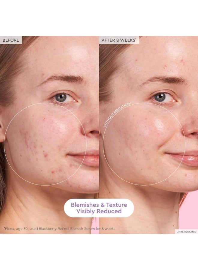 GLOW RECIPE Blackberry Retinol Blemish Serum 30ml - Image 3